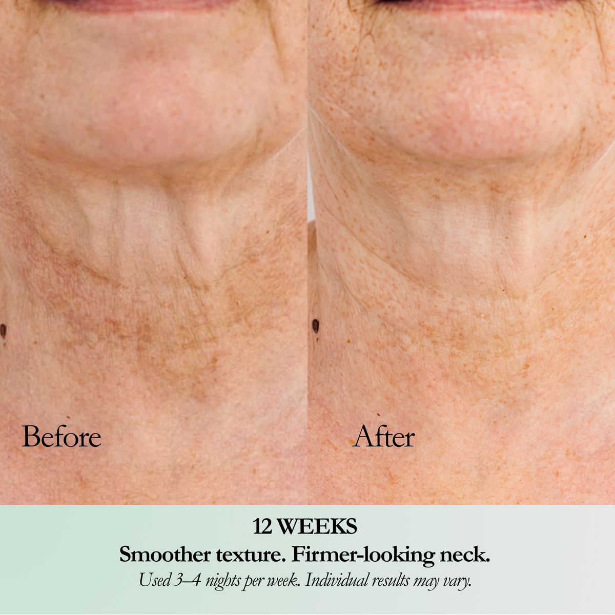 Retinol Peptide Night cream- Face & Neck