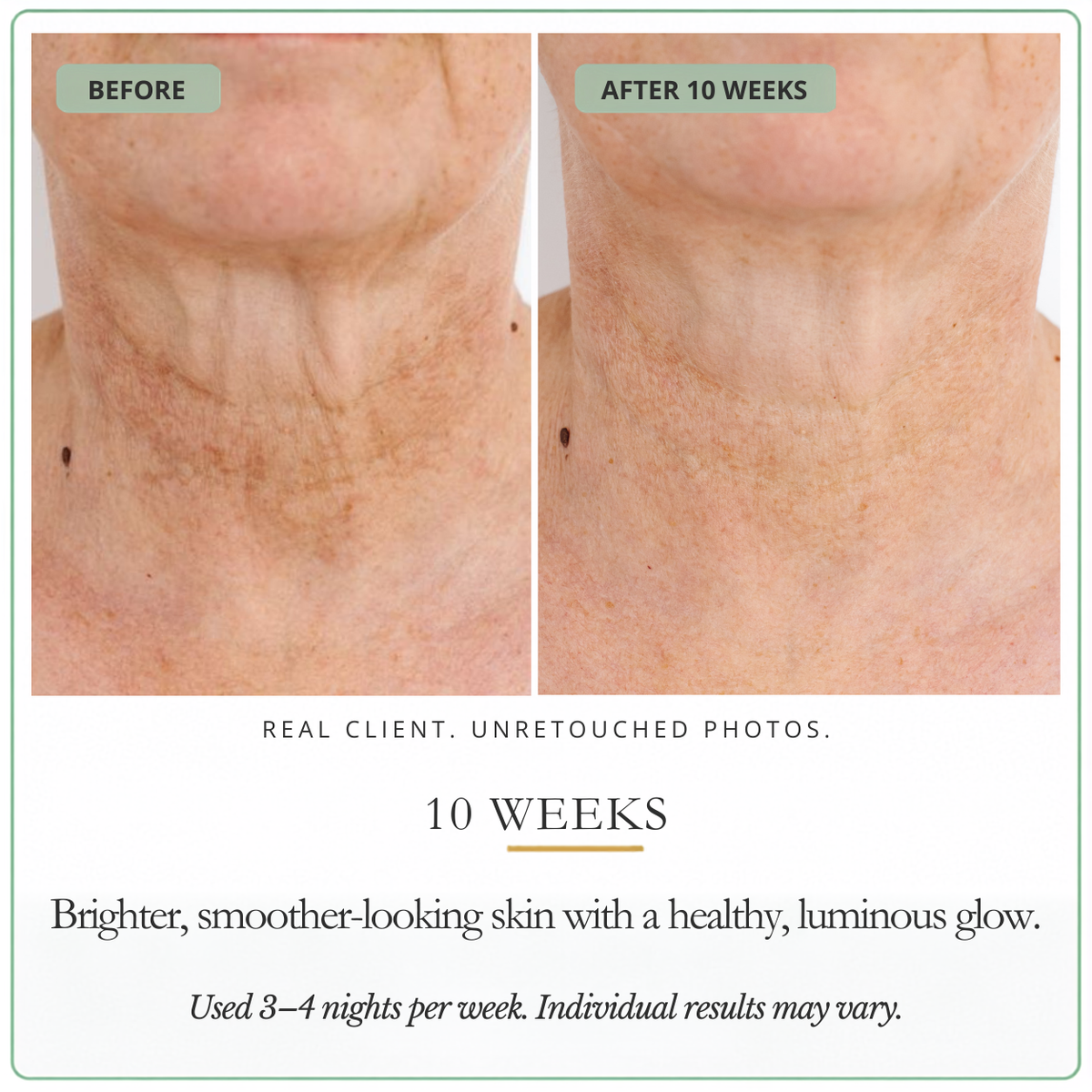 Retinol Peptide Night cream- Face & Neck